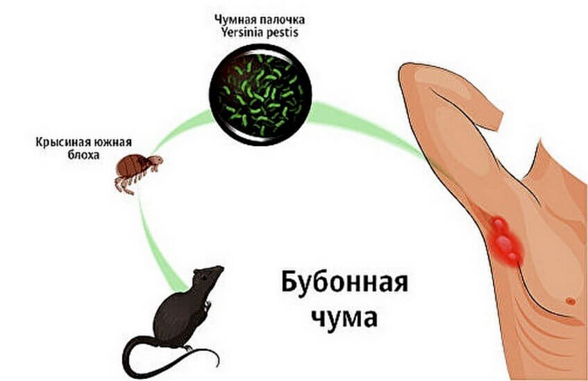 Вероятность завоза чумы угрожает России
