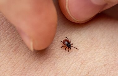 171 случай укуса клещами зарегистрирован в Сарове с марта