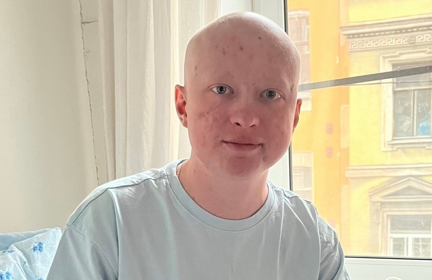 Неравнодушные саровчане помогают Егору Угарову побороть онкологию